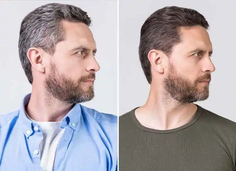 Before and after comparison showing a more defined groomed appearance