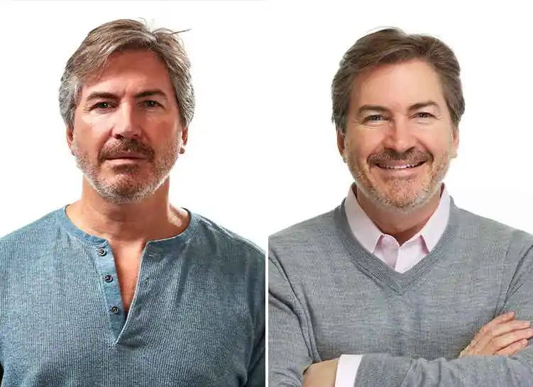 Before and after comparison showing reduced appearance of gray hair